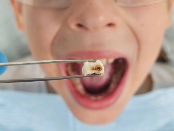 Best Pediatric Emergency Dentist in New Chicago, IN